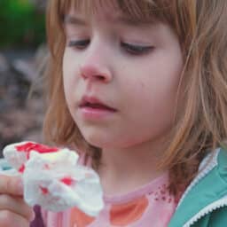 Small girl with nose injury